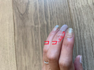 皮膚むしり症が治ったジェルネイル